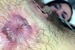 Risika Farting Thong and Hairy Asshole
