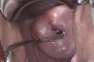 Cervix Play Insertion. Uterus fucking